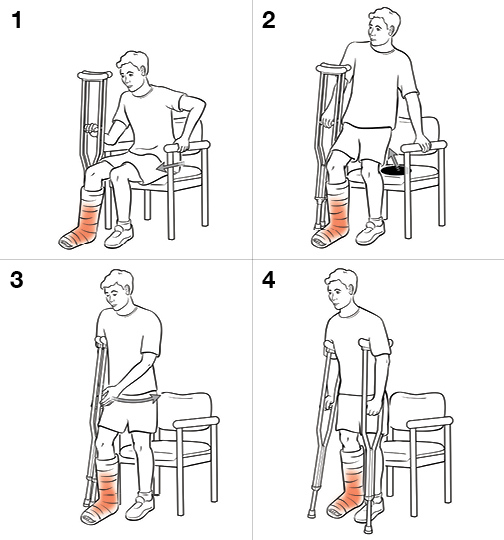 4 steps in standing with crutches (weight bearing).