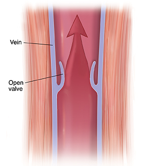 Man experiencing calf pain while walking.