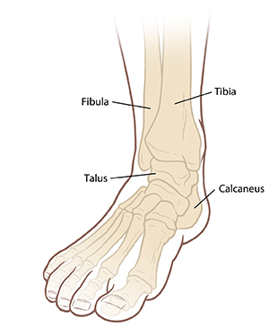 Front view of foot and ankle bones, including fibula, tibia, talus, and calcaneus.