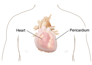 Front view of chest showing heart inside pericardium. 