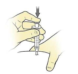 Closeup of gloved hands pressing plunger on syringe to give injection.