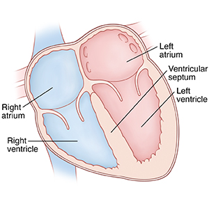 Cross section of heart showing atria on top and ventricles on bottom. Ventricular septum is between ventricles.