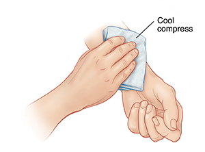 Hand placing cool compress on inner forearm of opposite arm.