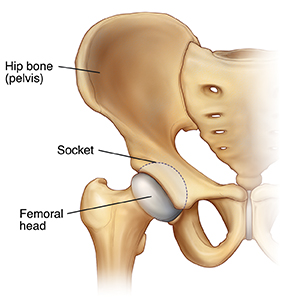 Vista frontal del hueso de la cadera que muestra la cabeza femoral del fémur en el acetábulo de la cadera.